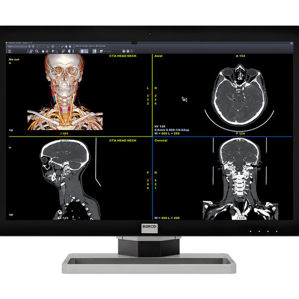 Barco Coronis Fusion MDCC-6430 6MP 30