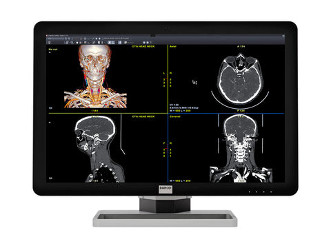 Barco Coronis Fusion MDCC-6430 6MP 30