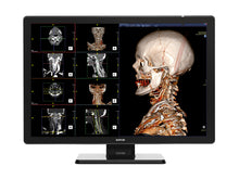 Barco Coronis Fusion MDCC-6530 6MP 30" Color Medical Diagnostic Radiology Monitor