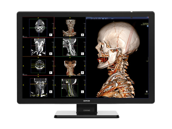 Barco Coronis Fusion MDCC-6530 6MP 30" Color Medical Diagnostic Radiology Monitor