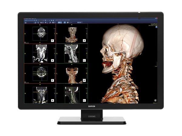 Complete PACS General Radiology Station | Barco Coronis MDCC-6530 6MP Color LED Display | HP Workstation | Dictation Mic | Worklist Monitor (6530Z4R)