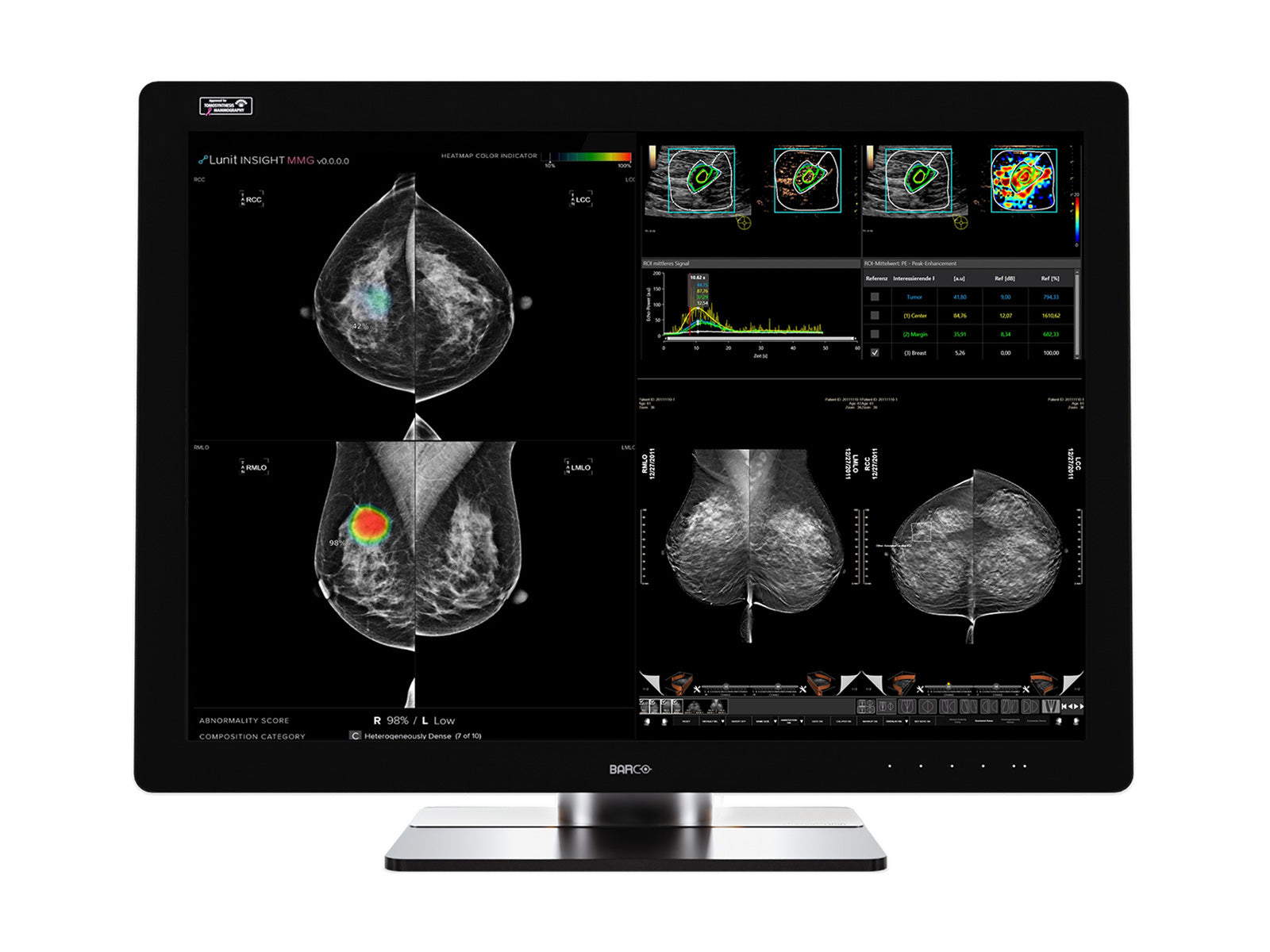 Estación completa de lectura de mamografías | Barco Coronis UNITI 12MP | Estación de trabajo HP Z4 G5 | Micrófono de dictado | Monitores de lista de trabajo (12133Z4G5R)