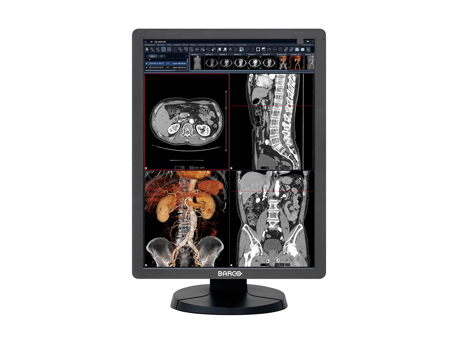Barco Eonis MDRC-2321 2MP 21" SNIB HLX Color Clinical Review Display (K9350315)