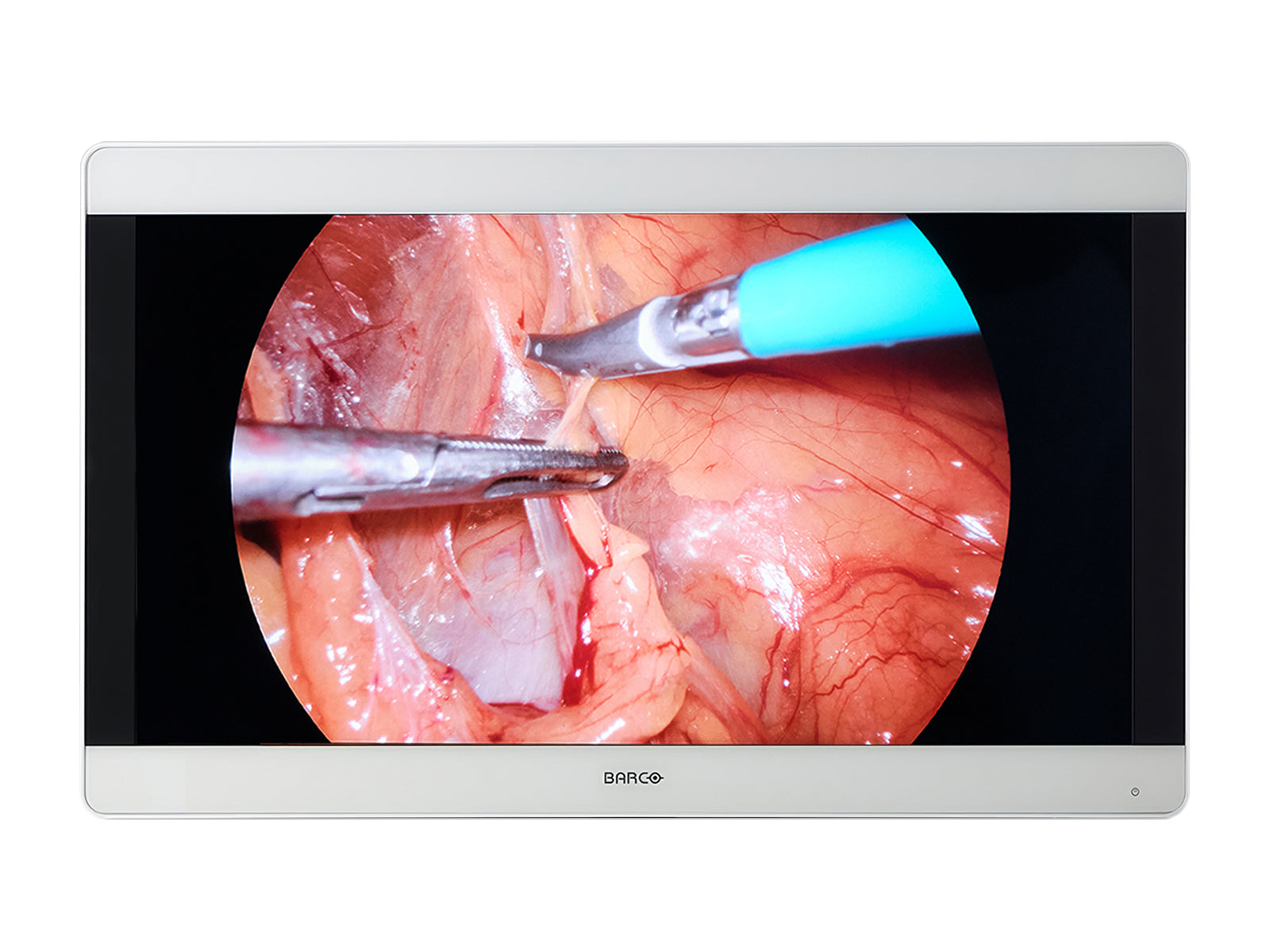 Barco MDSC-8231 32” 4K UHD Color Surgical Medical Display Monitor (K930792502)