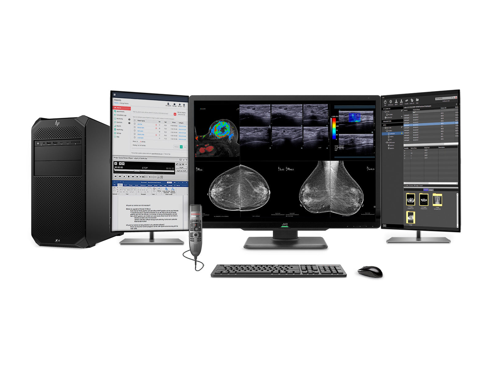 Complete Mammography Reading Station | JVC Totoku CL-S1200 12MP Color Display | HP Z4 G5 Workstation | Dictation Mic | Worklist Monitors (CLS1200Z4G5)