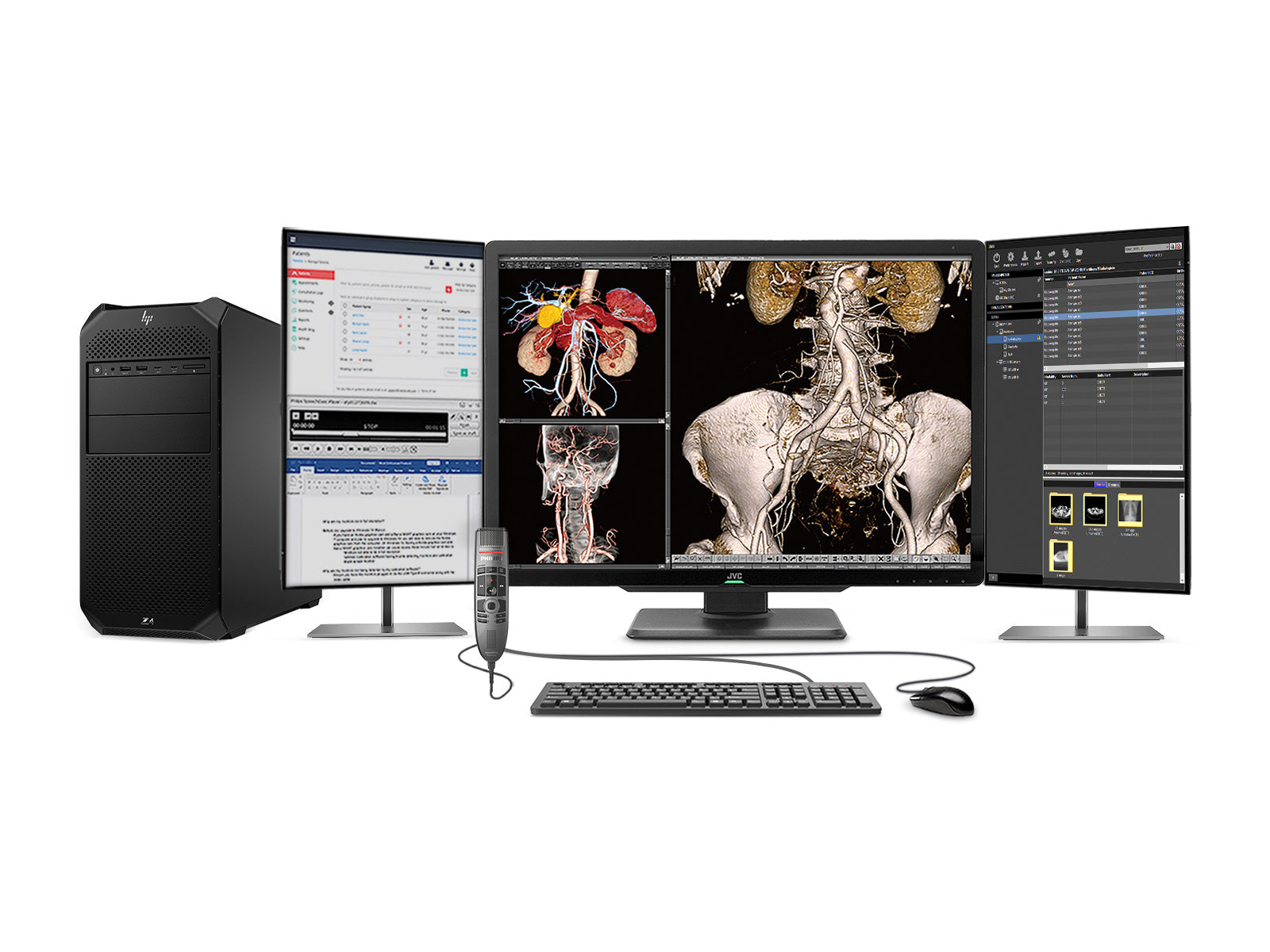 Komplette PACS-Station für allgemeine Radiologie | JVC Totoku 6MP Farbdisplay | HP Z4 G5 Workstation | Diktiermikrofon | Arbeitsvorratsmonitor (S600Z4G5)