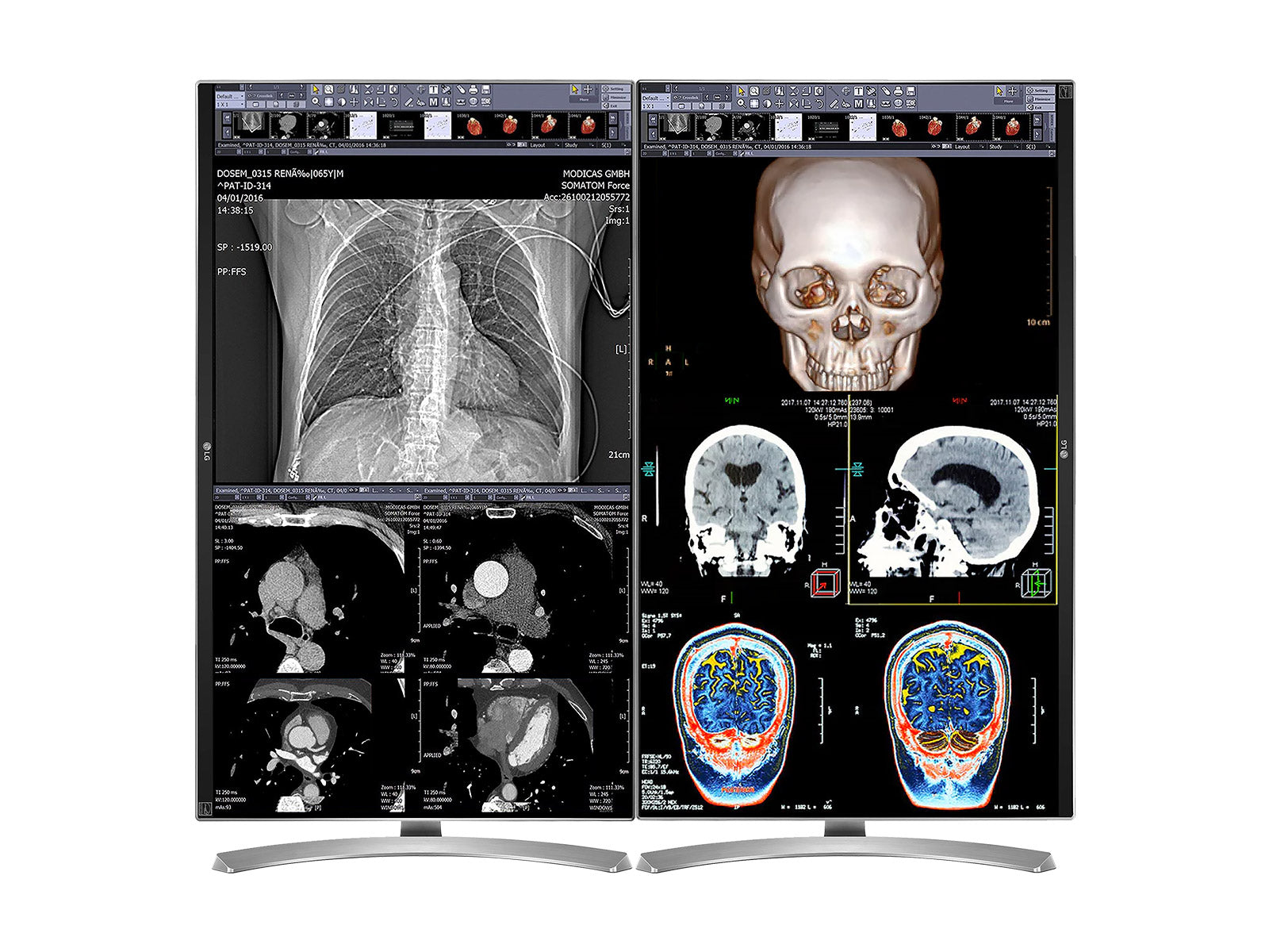 Stazione di lettura della revisione clinica completa | 2 x lg 27 "8 MP Display clinici a colori | HP Zbook Studio 16 G9 | MIC DIMATION | Pacchetto di calibrazione PerfectLum (LGHP16G9)