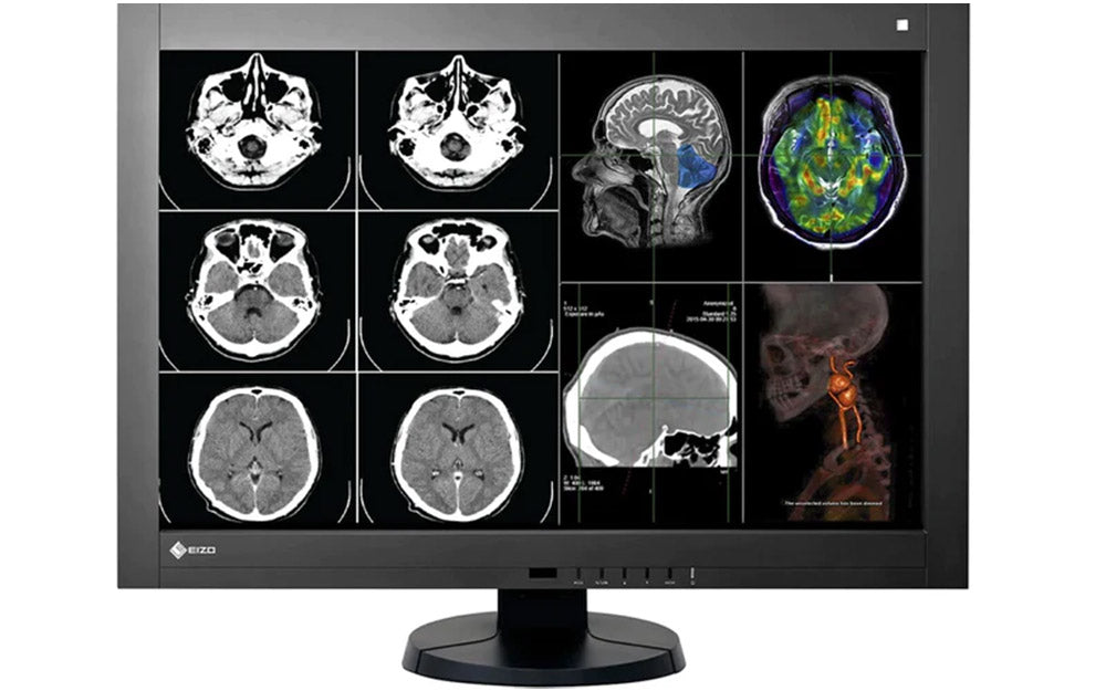 Eizo RadiForce RX440 4MP 30
