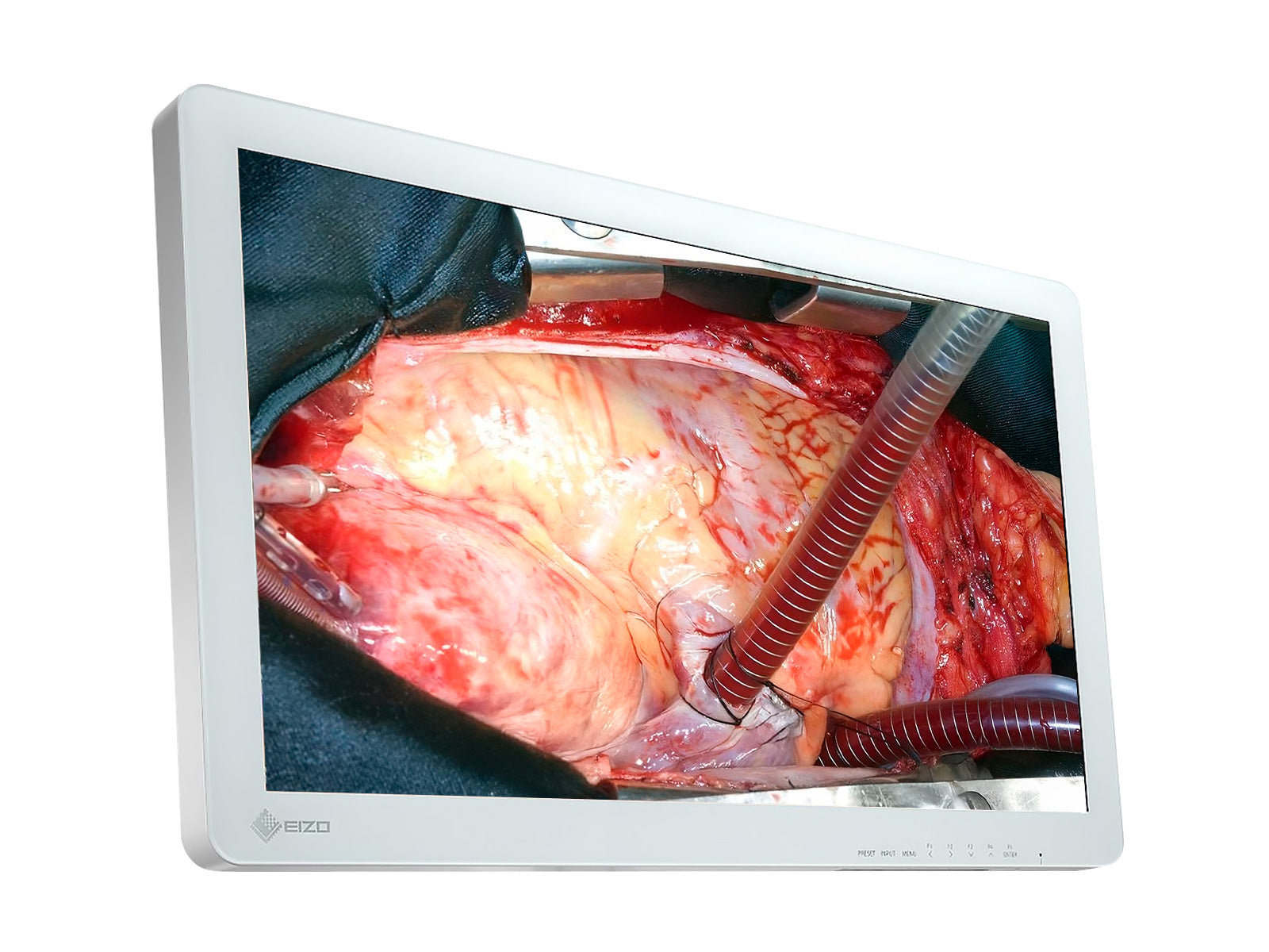 Eizo EX2620 LED 26" FHD Surgical LCD Monitor (EX2620)