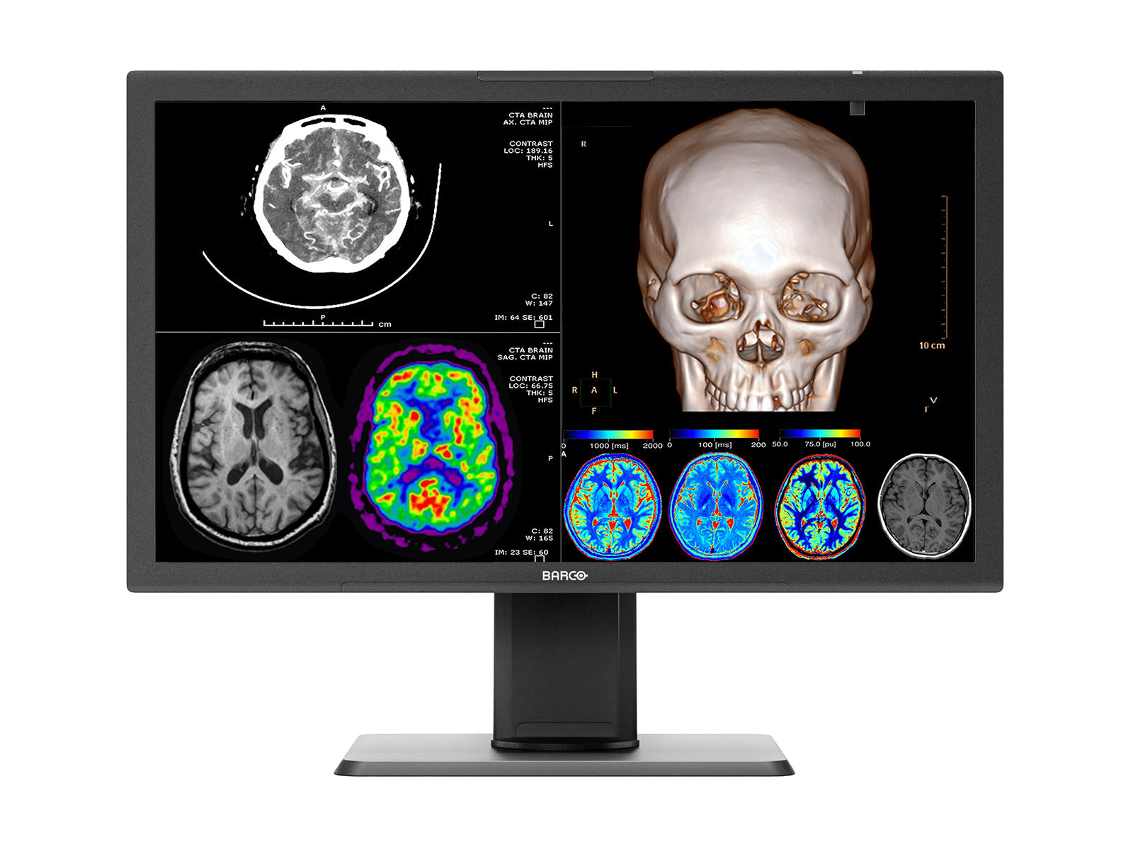 Barco 27" 4K 8MP MDPC‑8127 Diagnostic Radiology Medical Display Monitor (K9610269)