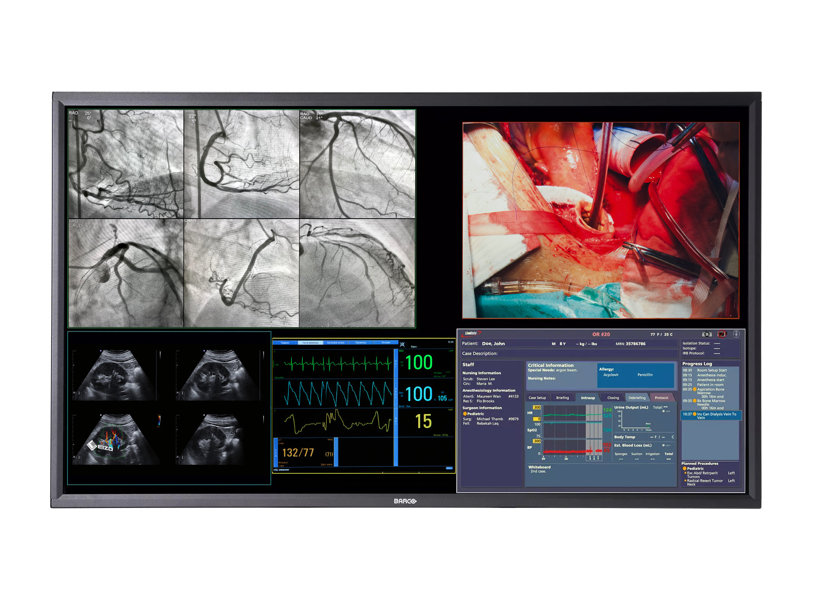 Barco MDSC-8358 RLG 58" 8MP 4K Surgical Medical Display Monitor (K9307940)