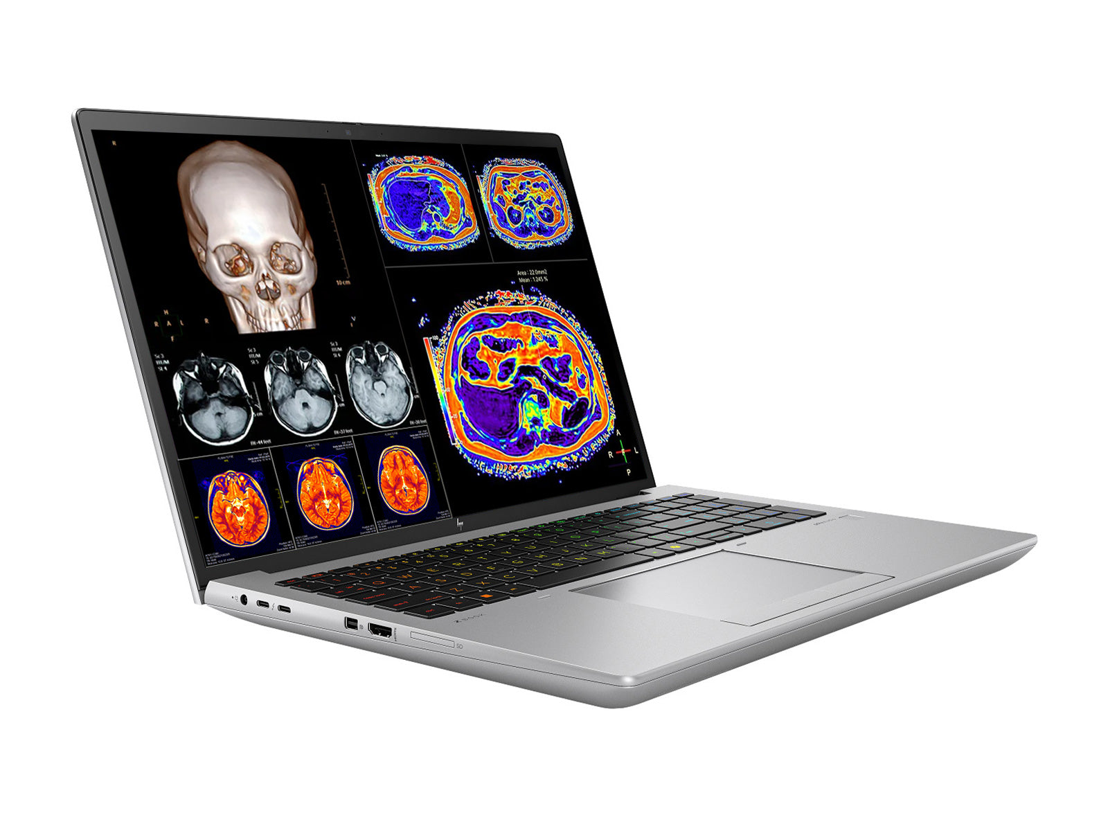 (Template)HP ZBook Fury 16 G11 Mobile Radiology Workstation | 16" 9MP 4K+ UHD DICOM Calibrated | Core i7-14700HX @ 5.5GHz | 20-Core | 32GB DDR5 | 1TB NVMe SSD | RTX 1000 Ada 6GB | WiFi 7 | Win11 Pro