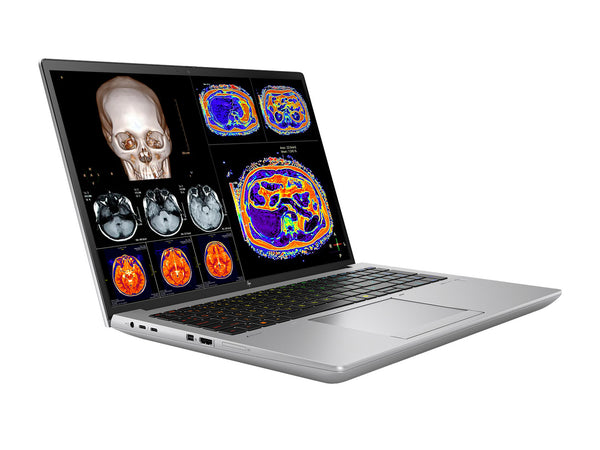 (Template)HP ZBook Fury 16 G11 Mobile Radiology Workstation | 16