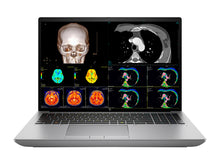 HP ZBook Fury 16 G11 Estação de trabalho móvel para radiologia | Tela OLED de 16" 9MP 4K+ UHD DICOM calibrado | Núcleo i9-14900HX a 5,8 GHz | 24 núcleos | 128GB DDR5 | 1TB SSD NVMe | RTX 5000 Ada 16GB | WiFi 6E