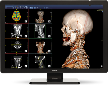 NEW Barco Coronis Fusion 6MP with Protective Glass!
