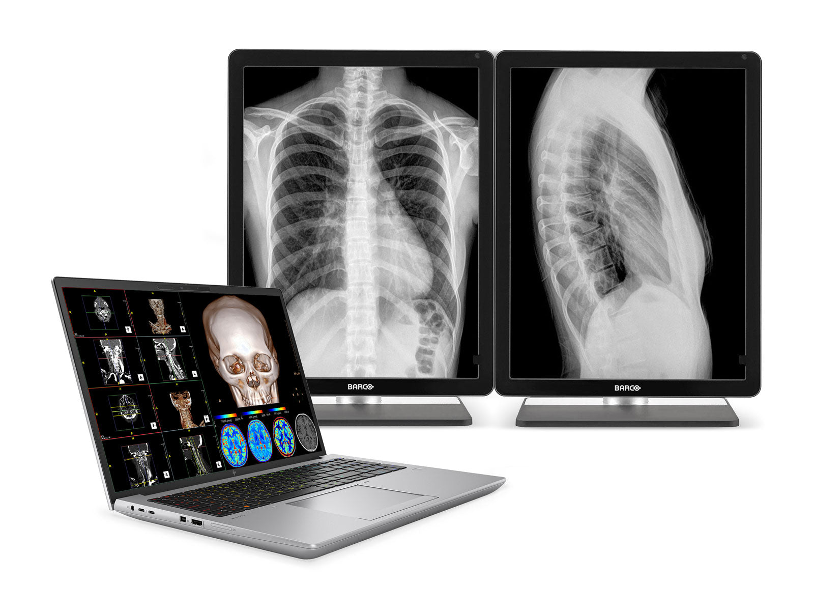 HP ZBook Fury 16 G10 Mobile Radiology Workstation | 16" OLED 9MP 4K+ UHD DICOM Calibrated | Core i9-13950HX @ 5.50GHz | 24-Core | 64GB DDR5 | 1TB NVMe SSD | RTX 5000 Ada 16GB | WiFi 6E
