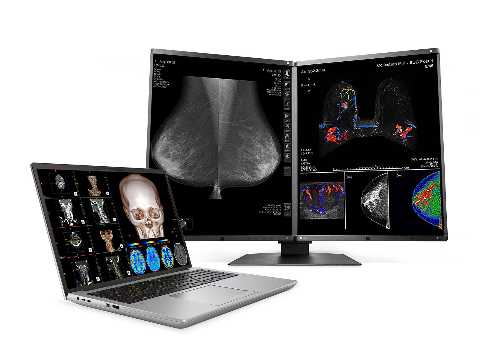 HP ZBook Fury 16 G10 Mobile Radiology Workstation | 16" OLED 9MP 4K+ UHD DICOM Calibrated | Core i9-13950HX @ 5.50GHz | 24-Core | 64GB DDR5 | 1TB NVMe SSD | RTX 5000 Ada 16GB | WiFi 6E