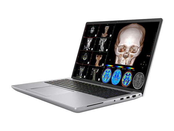 HP ZBook Fury 16 G10 Mobile Radiology Workstation | 16