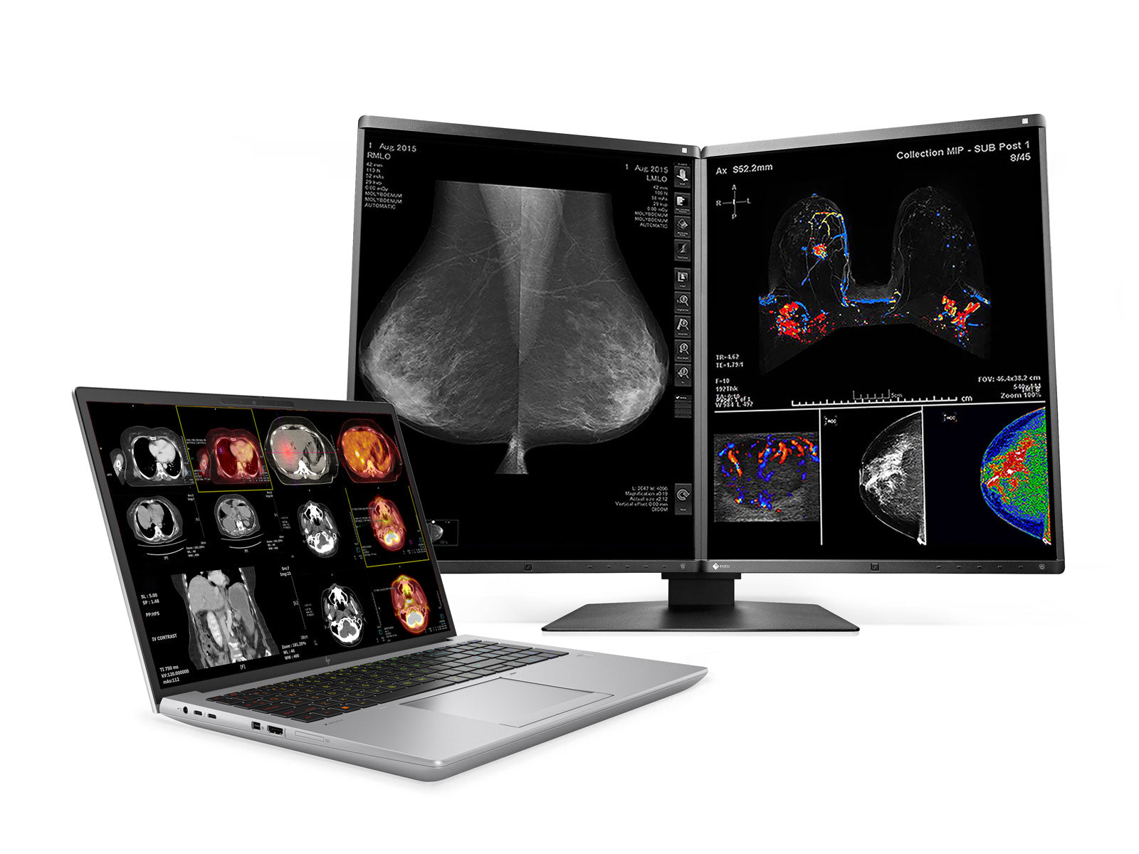 HP ZBook Fury 16 G10 Mobile Radiology Workstation | 16" WUXGA DICOM Calibrated | Core i9-13950HX @ 5.5GHz | 128GB DDR5 | 1TB NVMe SSD | RTX 5000 Ada 16GB | WiFi 6E