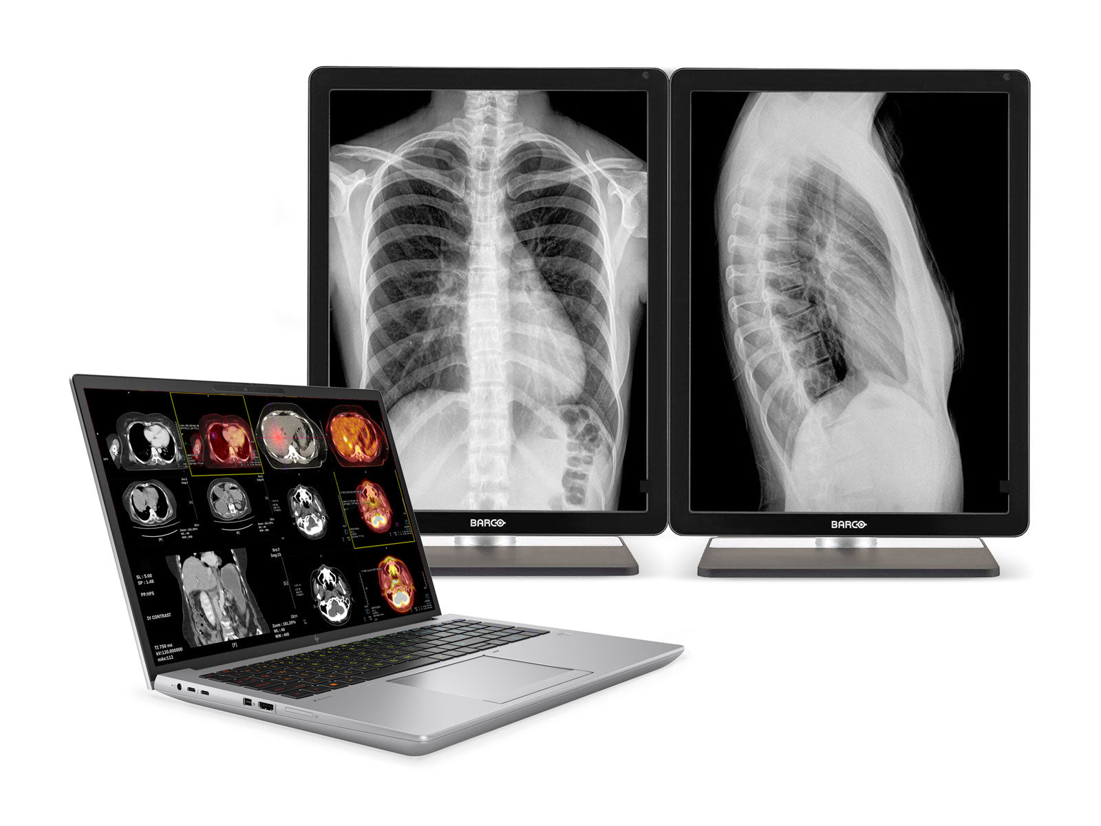 HP ZBook Fury 16 G10 Mobile Radiology Workstation | 16" WUXGA DICOM Calibrated | Core i9-13950HX @ 5.5GHz | 128GB DDR5 | 1TB NVMe SSD | RTX 5000 Ada 16GB | WiFi 6E