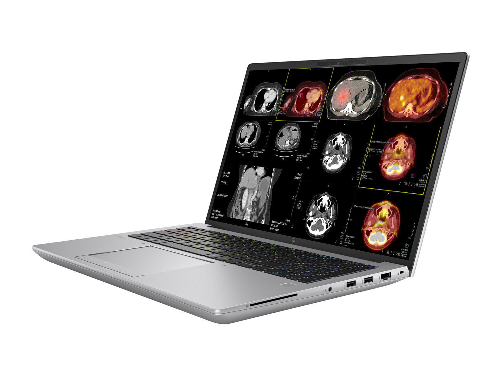 HP ZBook Fury 16 G10 Mobile Radiology Workstation | 16" WUXGA DICOM Calibrated | Core i9-13950HX @ 5.5GHz | 128GB DDR5 | 1TB NVMe SSD | RTX 5000 Ada 16GB | WiFi 6E