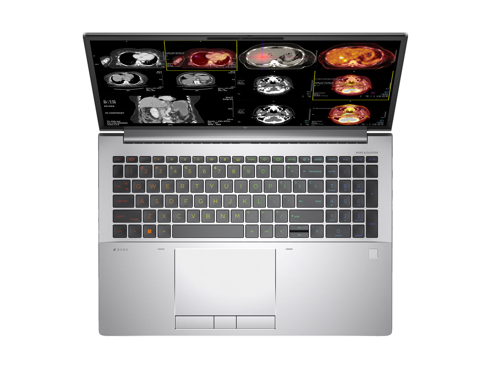 HP ZBook Fury 16 G10 Mobile Radiology Workstation | 16" 8MP 4K UHD DICOM Calibrated | Core i9-13950HX @ 5.5GHz | 128GB DDR5 | 1TB NVMe SSD | RTX 5000 Ada 16GB | WiFi 6E