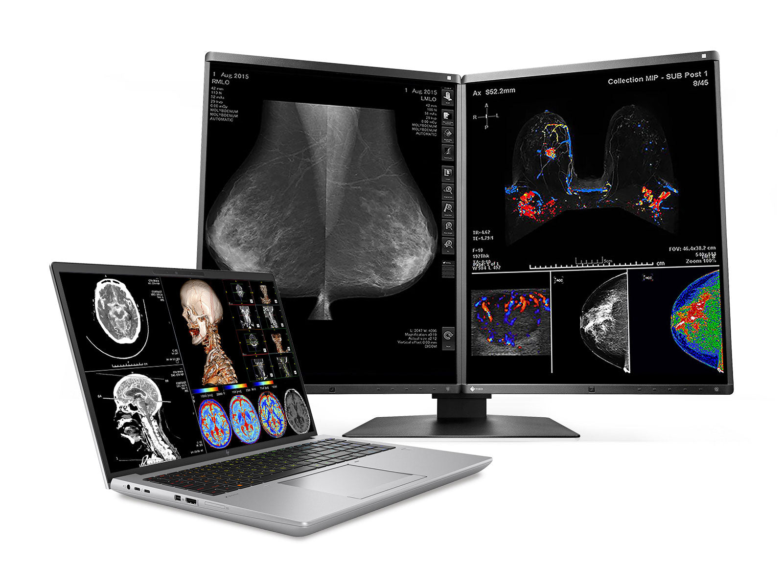 Estación de trabajo de radiología móvil HP ZBook Fury 16 G9 | WUXGA DICOM de 16" calibrado | Núcleo i7-12800HX @ 4.80GHz | 16 núcleos | 128 GB de memoria DDR5 | SSD NVMe de 1 TB | Radeon Pro W6600M 8GB | WiFi 6 | Win10-11 A favor