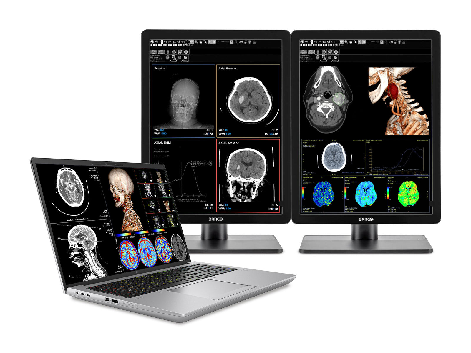 Estação de trabalho de radiologia móvel HP ZBook Fury 16 G9 | Calibrado WUXGA DICOM de 16" | Núcleo i7-12800HX @ 4.80GHz | 16 núcleos | 128 GB DDR5 | SSD NVMe de 1 TB | Radeon Pro W6600M 8GB | Wi-Fi 6 | Win10-11 Profissional