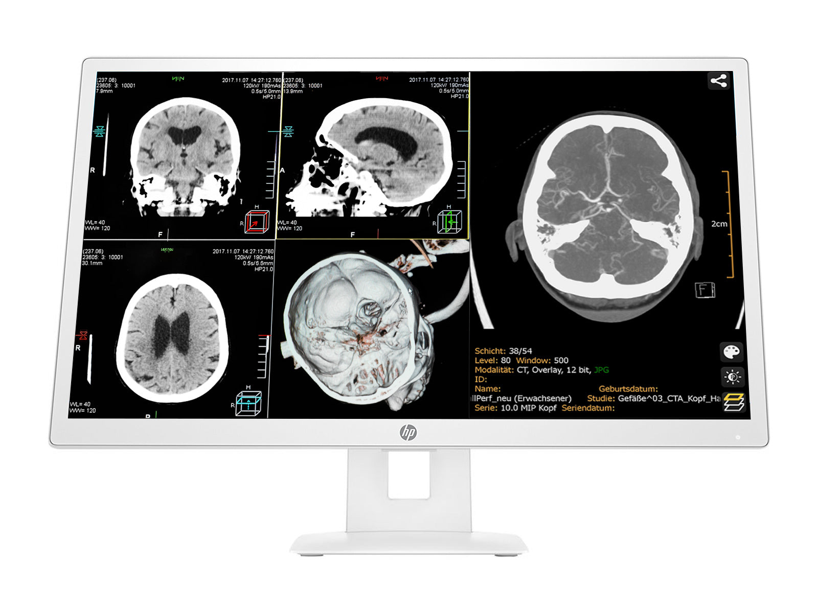 HP 27" 3MP DICOM Clinical Review Medical Display Monitor