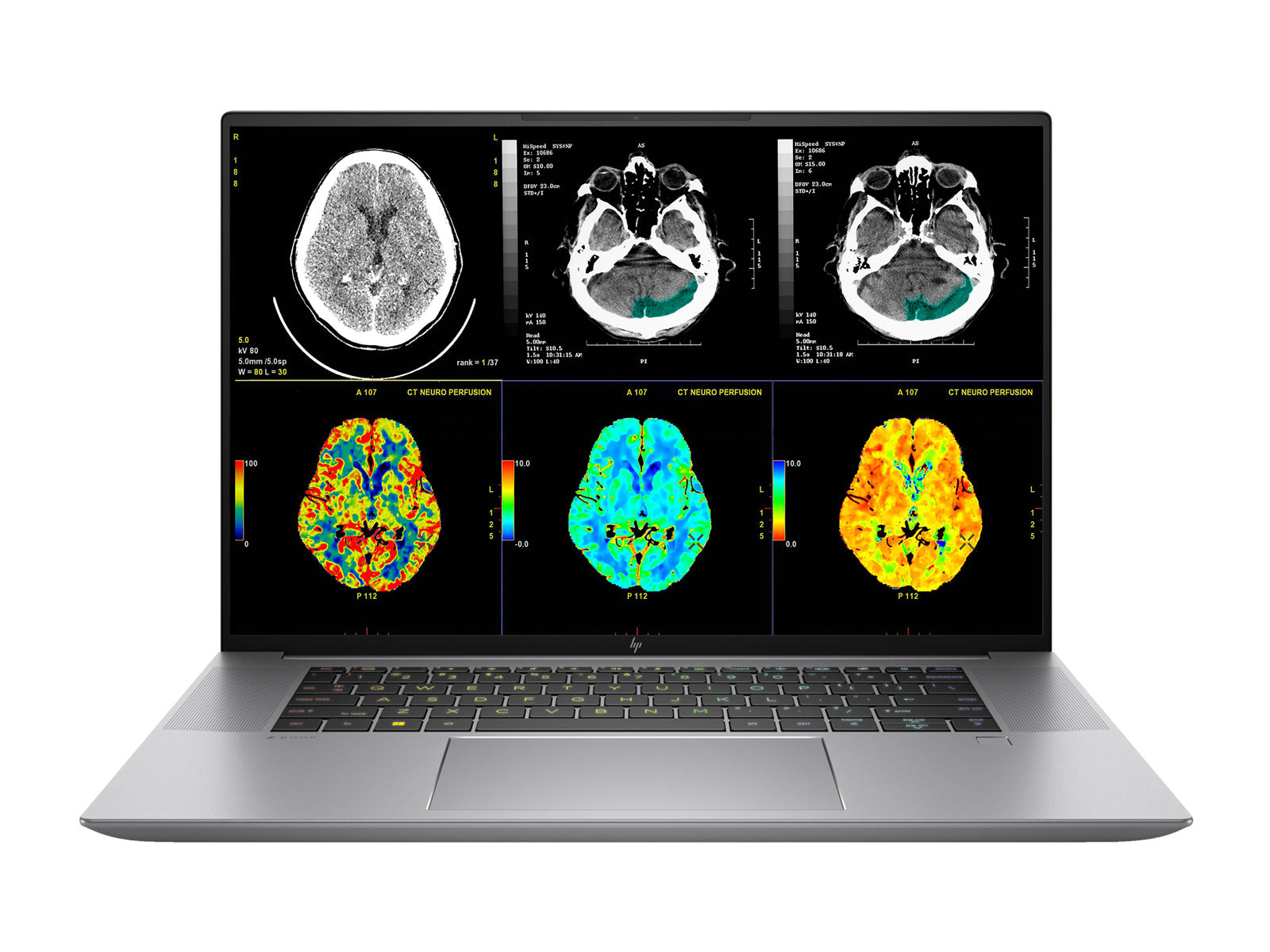 Complete Clinical Review Reading Station | 2 x LG 27" 8MP Color Clinical Review Displays | HP ZBook Studio 16 G10 | Dictation Mic | PerfectLUM Calibration Package (LGHP16G10)