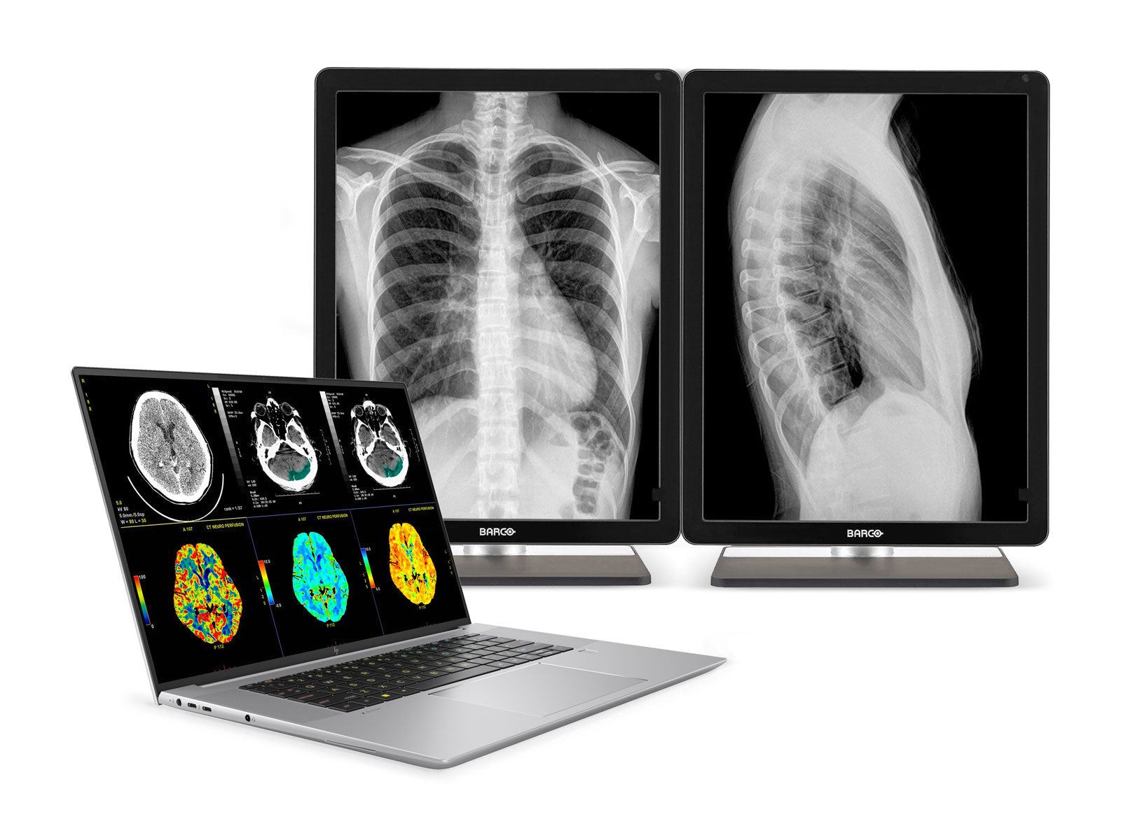HP ZBook Studio 16 G10 Mobile Radiology Workstation | 16" 9MP 4K UHD DICOM Calibrated | Core i7-13800H @ 5.2GHz | 64GB DDR5 | 512GB NVMe SSD | NVIDIA RTX A1000 6GB