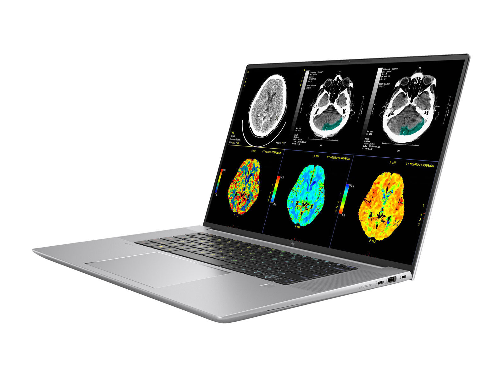 HP ZBook Studio 16 G10 Mobile Radiology Workstation | 16" 9MP 4K UHD DICOM Calibrated | Core i7-13800H @ 5.2GHz | 64GB DDR5 | 512GB NVMe SSD | NVIDIA RTX A1000 6GB