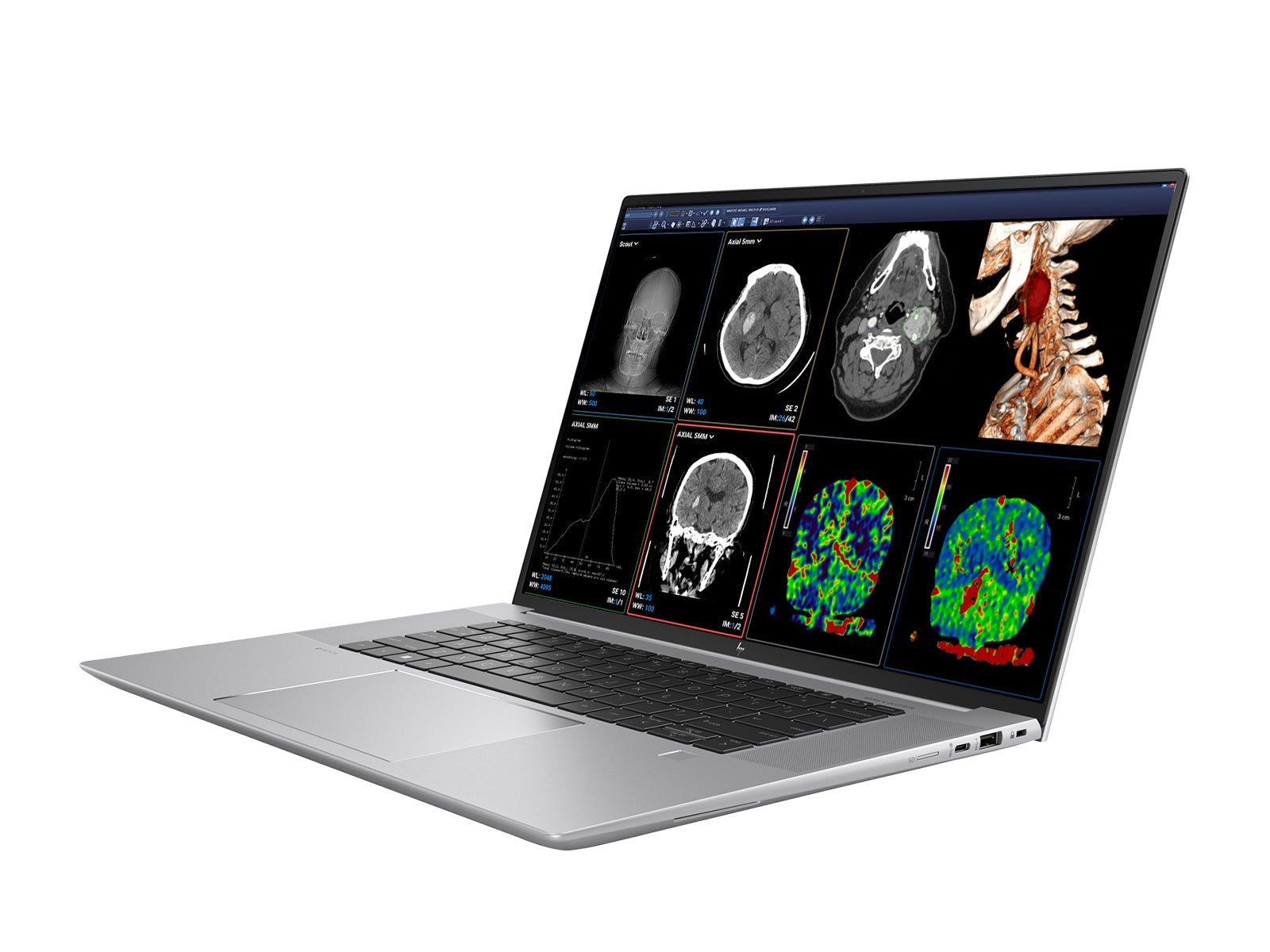 HP ZBook Studio 16 G9 Mobile Radiology Workstation |  16" WUXGA DICOM Calibrated | Intel i7-12800H @ 4.80GHz | 14-Core | 64GB DDR5 | 1TB NVMe SSD | NVIDIA RTX 3070 8GB | WiFi 6E | Win10-11 Pro