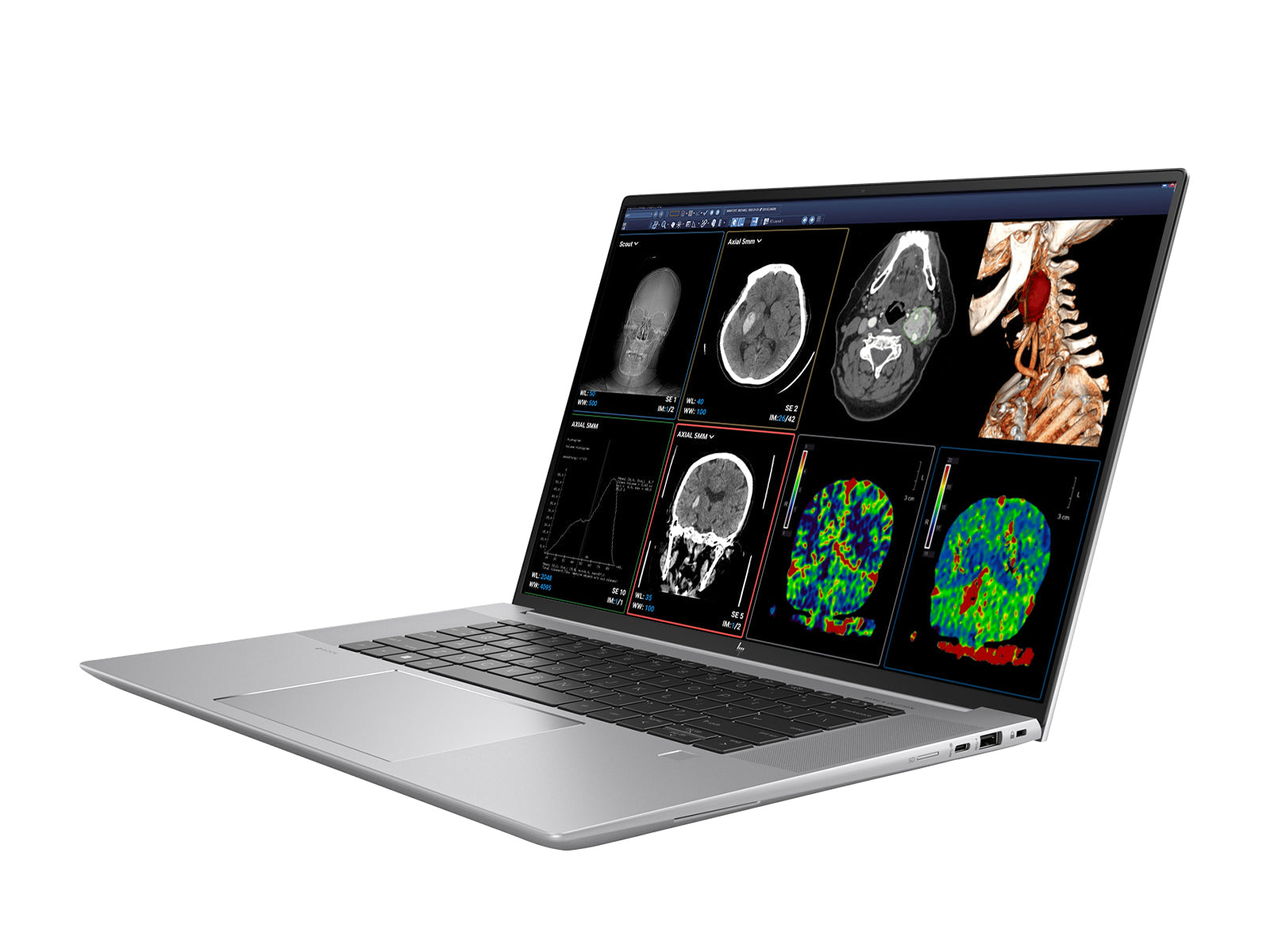 HP ZBook Studio 16 G9 Mobile Radiology Workstation | 16" WQUXGA 4K+ 9MP DICOM Calibrated | Intel i7-12800H @ 4.80GHz | 14-Core | 64GB DDR5 | 1TB NVMe SSD | NVIDIA RTX 3070 8GB | WiFi 6E | Win10-11 Pro