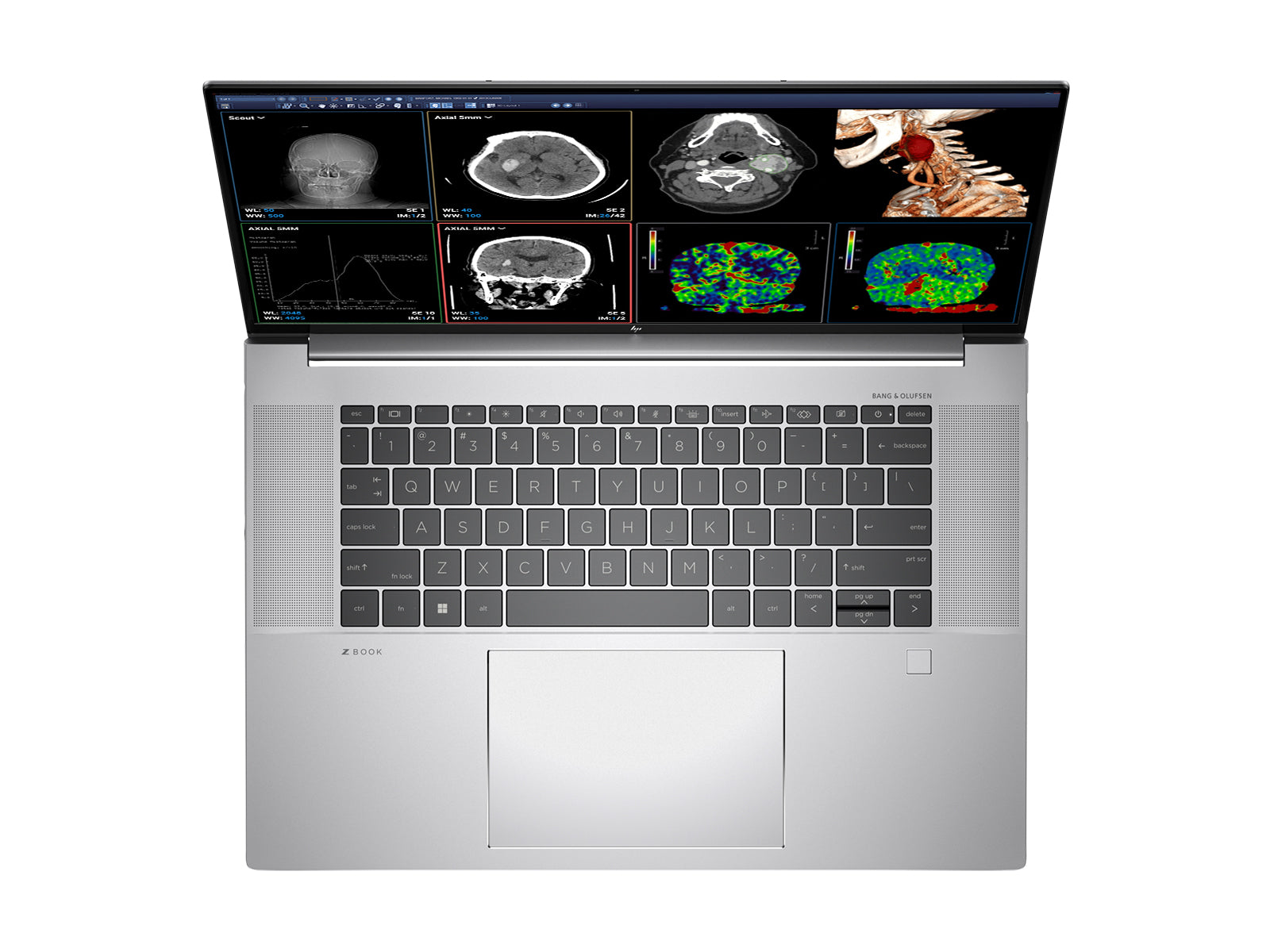 HP ZBook Studio 16 G9 Mobile Radiology Workstation |  16" WUXGA DICOM Calibrated | Intel i7-12800H @ 4.80GHz | 14-Core | 64GB DDR5 | 1TB NVMe SSD | NVIDIA RTX 3070 8GB | WiFi 6E | Win10-11 Pro