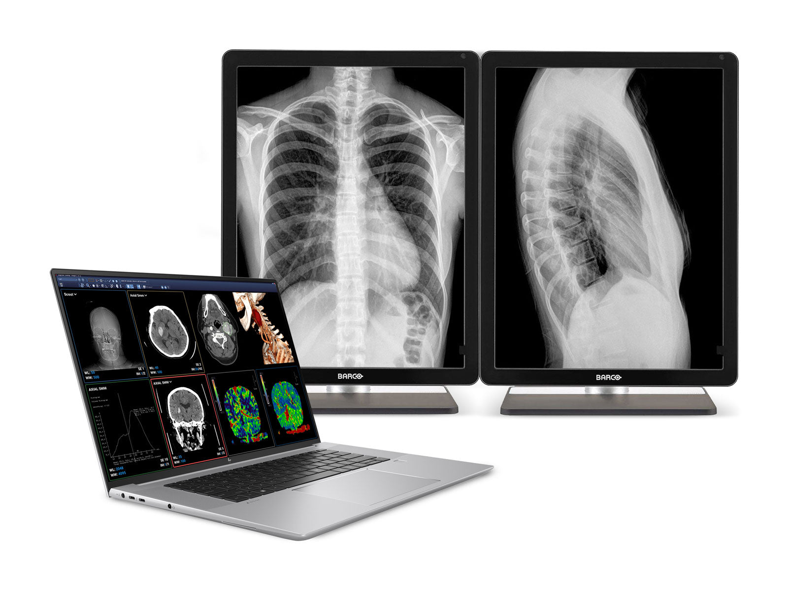 Estación de trabajo de radiología móvil HP ZBook Studio 16 G9 | OLED de 16" 9MP 4K UHD DICOM calibrado | Núcleo i9-12900H @ 5.00GHz | DDR5 de 64 GB | SSD NVMe de 1 TB | Nvidia RTX A1000 de 4 GB | Win11 Pro