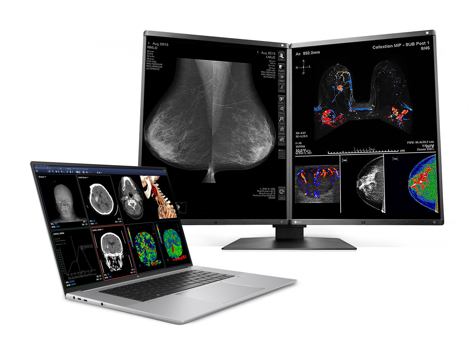 Estación de trabajo de radiología móvil HP ZBook Studio 16 G9 | OLED de 16" 9MP 4K UHD DICOM calibrado | Núcleo i9-12900H @ 5.00GHz | DDR5 de 64 GB | SSD NVMe de 1 TB | Nvidia RTX A1000 de 4 GB | Win11 Pro