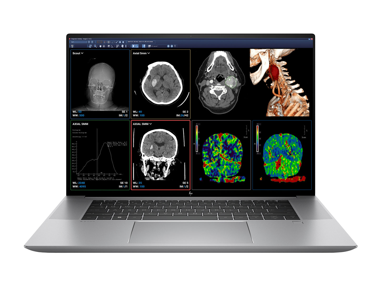 محطة قراءة المراجعة السريرية الكاملة | شاشتا مراجعة سريرية ملونة مقاس 27 بوصة من LG بدقة 8 ميجابكسل | HP ZBook Studio 16 G9 | ميكروفون الإملاء | حزمة معايرة PerfectLUM (LGHP16G9)