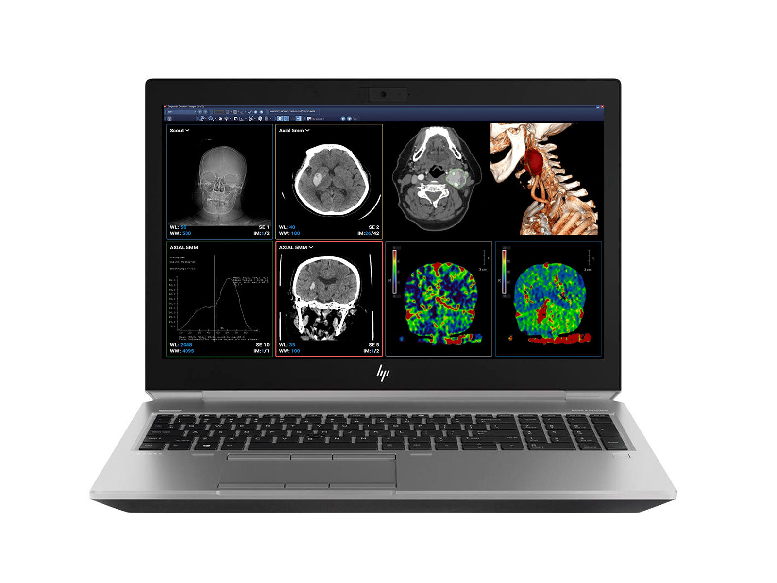 HP ZBook Fury 15 G6 Mobile Radiology Workstation | 15.6" Full HD LED | Intel i7-9750H @ 4.50GHz | 6-Core | 32GB DDR4 | 512GB NVMe SSD | NVIDIA Quadro T1000 4GB | Win10 Pro