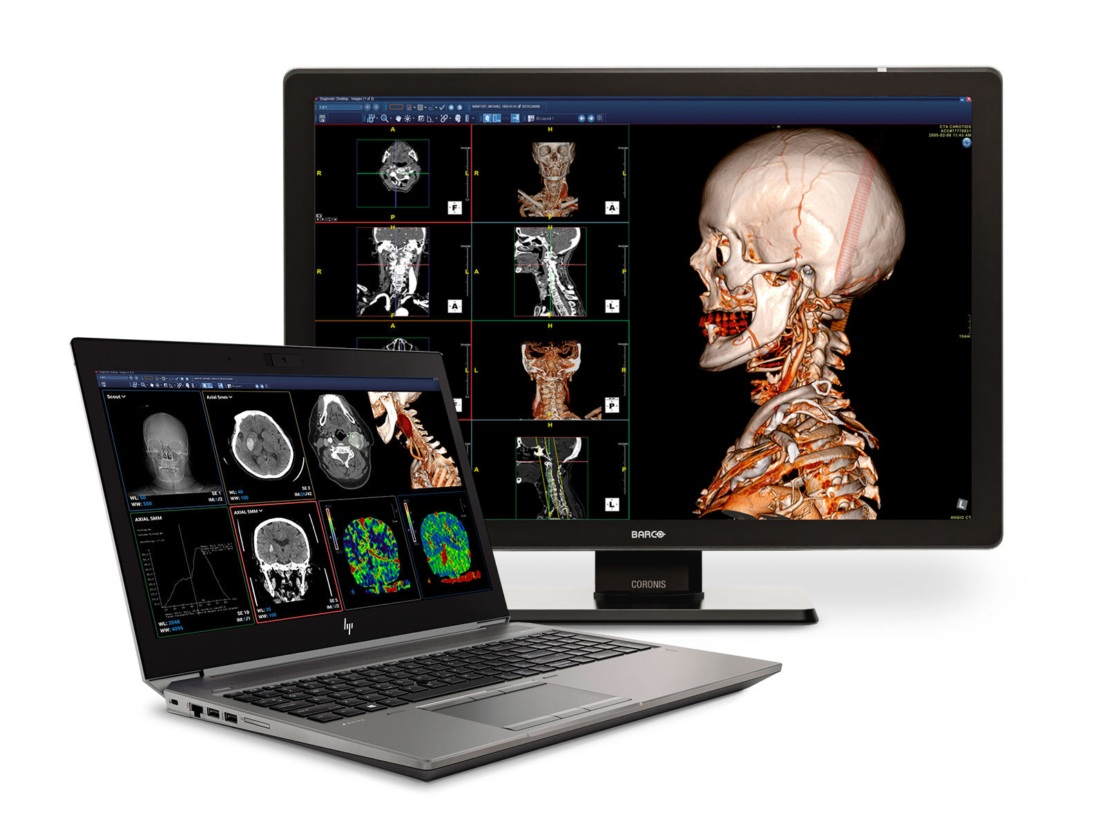 HP ZBook Fury 15 G6 Mobile Radiology Workstation | 15.6" Full HD LED | Intel i7-9750H @ 4.50GHz | 6-Core | 32GB DDR4 | 512GB NVMe SSD | NVIDIA Quadro T1000 4GB | Win10 Pro