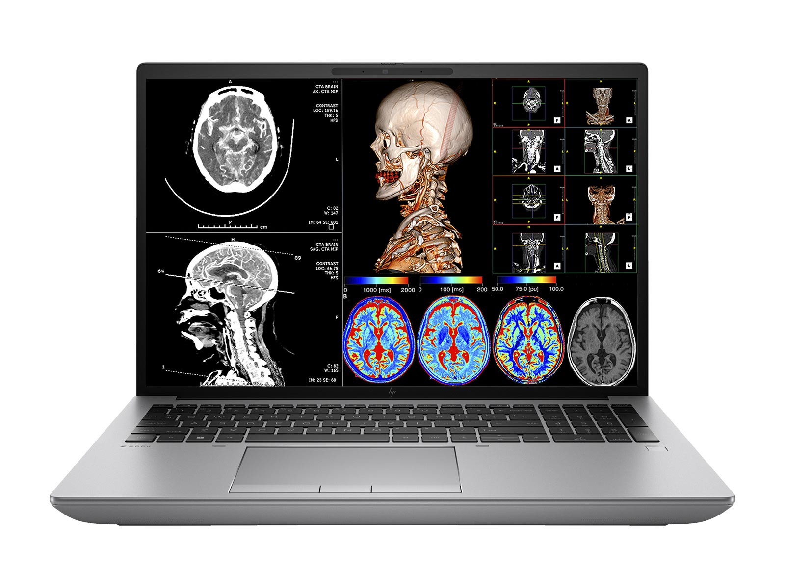 HP ZBook Fury 16 G9 mobiel radiologisch werkstation | 16" 9MP 4K UHD DICOM gekalibreerd | Core i7-12800HX @ 4,80 GHz | 16-kern | 32 GB DDR5 | NVMe SSD van 1 TB | Radeon Pro W6600M 8GB | Wifi 6 | Win10-11 Pro