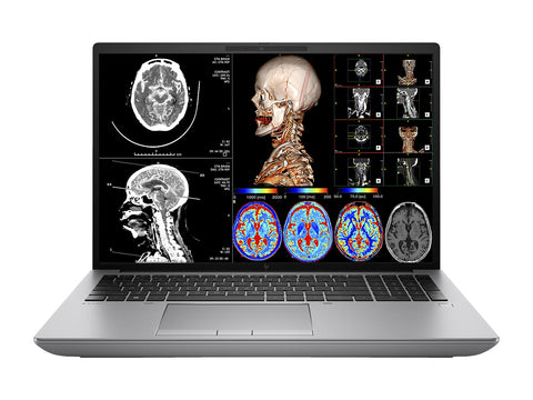 Estação de trabalho de radiologia móvel HP ZBook Fury 16 G9 | 16