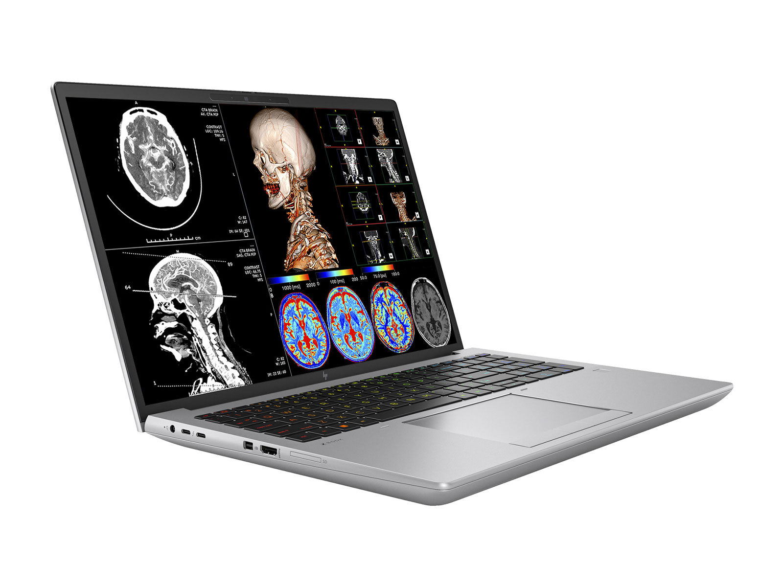 Estación de trabajo de radiología móvil HP ZBook Fury 16 G9 | WUXGA DICOM de 16" calibrado | Núcleo i7-12800HX @ 4.80GHz | 16 núcleos | 128 GB de memoria DDR5 | SSD NVMe de 1 TB | Radeon Pro W6600M 8GB | WiFi 6 | Win10-11 A favor