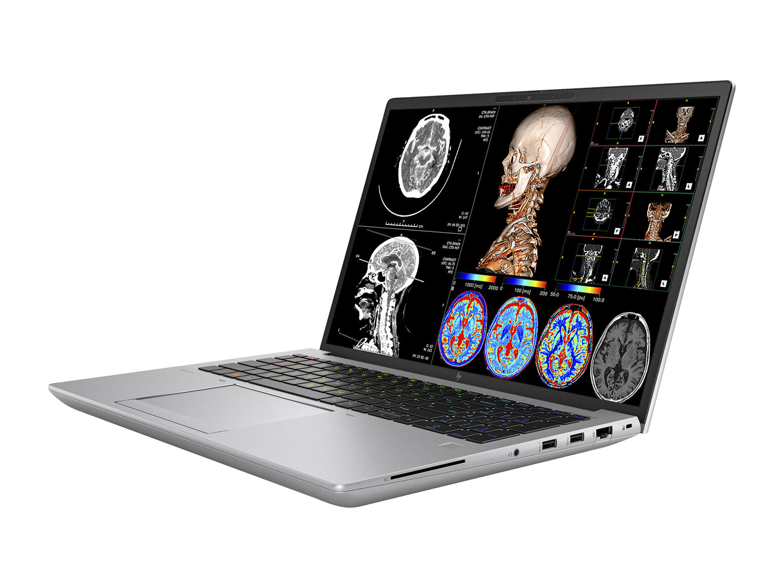 Estação de trabalho de radiologia móvel HP ZBook Fury 16 G9 | 16" 9MP 4K UHD DICOM Calibrado | Núcleo i7-12800HX @ 4.80GHz | 16 núcleos | 32 GB DDR5 | SSD NVMe de 1 TB | Radeon Pro W6600M 8GB | Wi-Fi 6 | Win10-11 Profissional