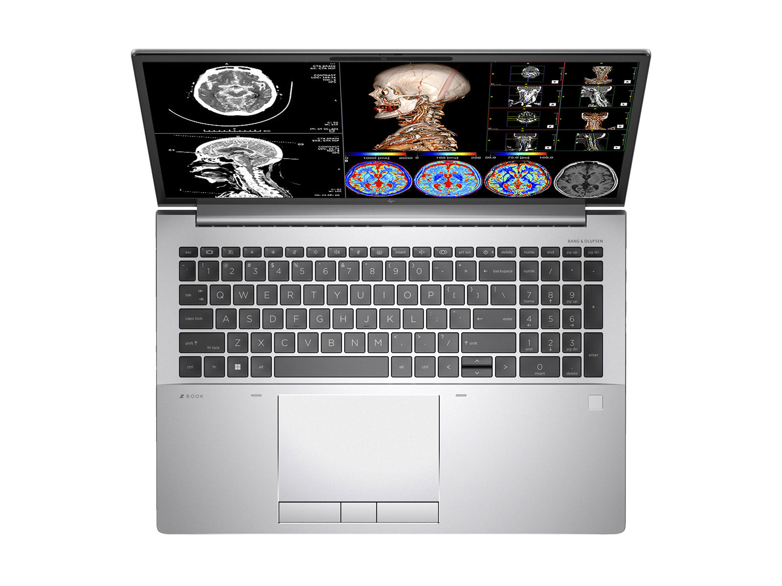 Estação de trabalho de radiologia móvel HP ZBook Fury 16 G9 | 16" 9MP 4K UHD DICOM Calibrado | Núcleo i7-12800HX @ 4.80GHz | 16 núcleos | 32 GB DDR5 | SSD NVMe de 1 TB | Radeon Pro W6600M 8GB | Wi-Fi 6 | Win10-11 Profissional