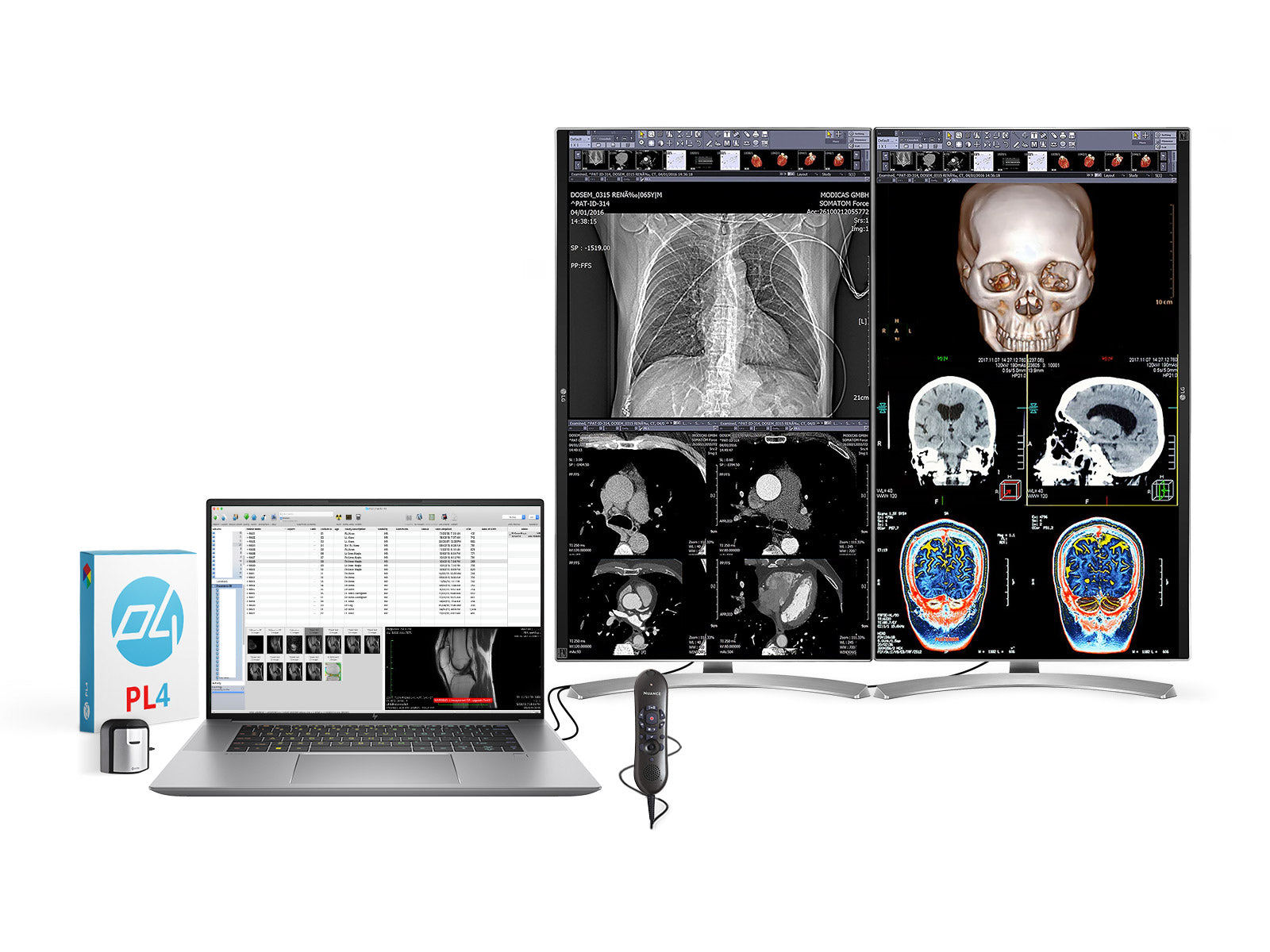 Teljes klinikai áttekintő olvasóállomás | 2 x LG 27 "8MP színes klinikai áttekintés | HP ZBOBOT Studio 16 G10 | Diktálás MIC | PerfectLum kalibrációs csomag (LGHP16G10)