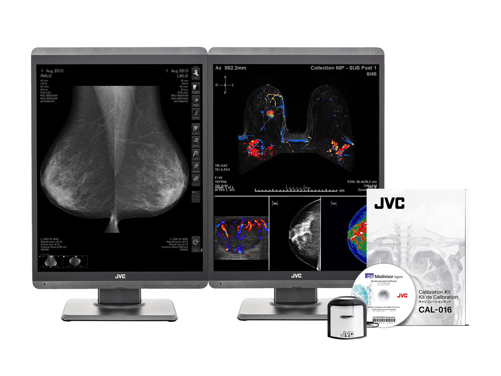Pair (x2) JVC Totoku CL-S500 5MP 21" Color LED Mammo 3D-DBT Breast Imaging Display (CL-S500)