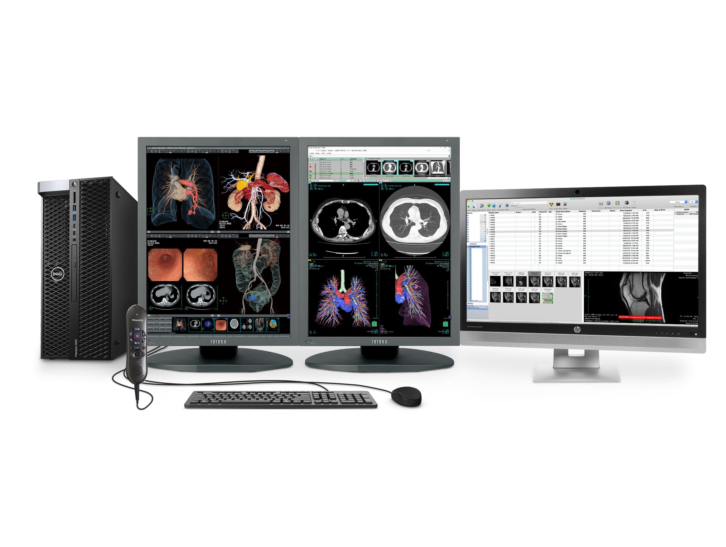 Complete PACS General Radiology Station | JVC Totoku 3MP Color Displays | Dell Workstation | Dictation Mic | Worklist Monitor (CCL3565I25820)
