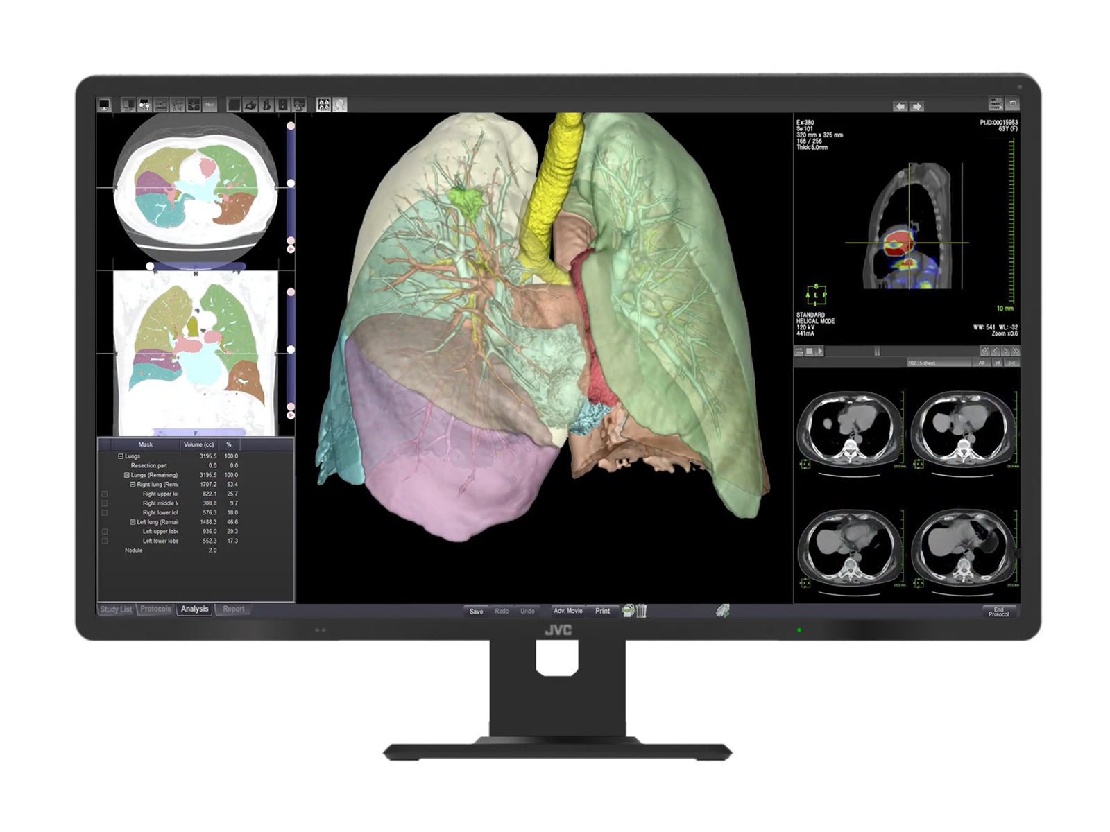 Komplette PACS-Station für allgemeine Radiologie | JVC Totoku 8MP Farbdisplay | HP Z4 G5 Workstation | Diktiermikrofon | Arbeitsvorratsmonitor (R813Z4G5)