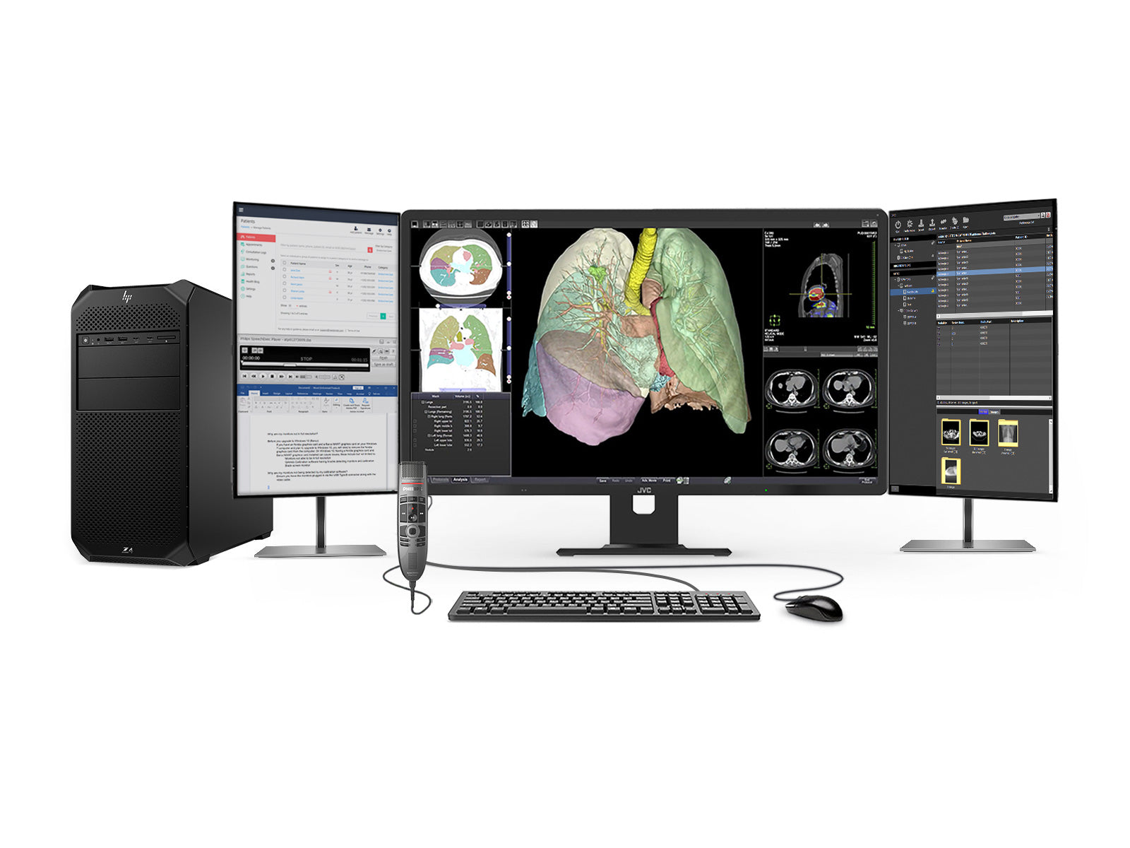 Komplette PACS-Station für allgemeine Radiologie | JVC Totoku 8MP Farbdisplay | HP Z4 G5 Workstation | Diktiermikrofon | Arbeitsvorratsmonitor (R813Z4G5)